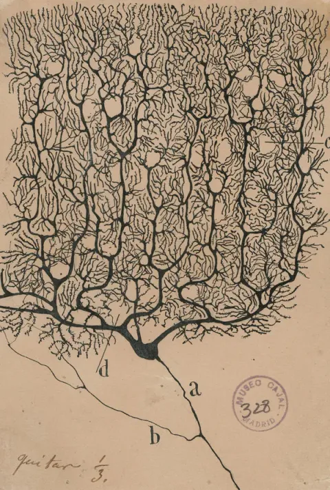 Purkinje cell